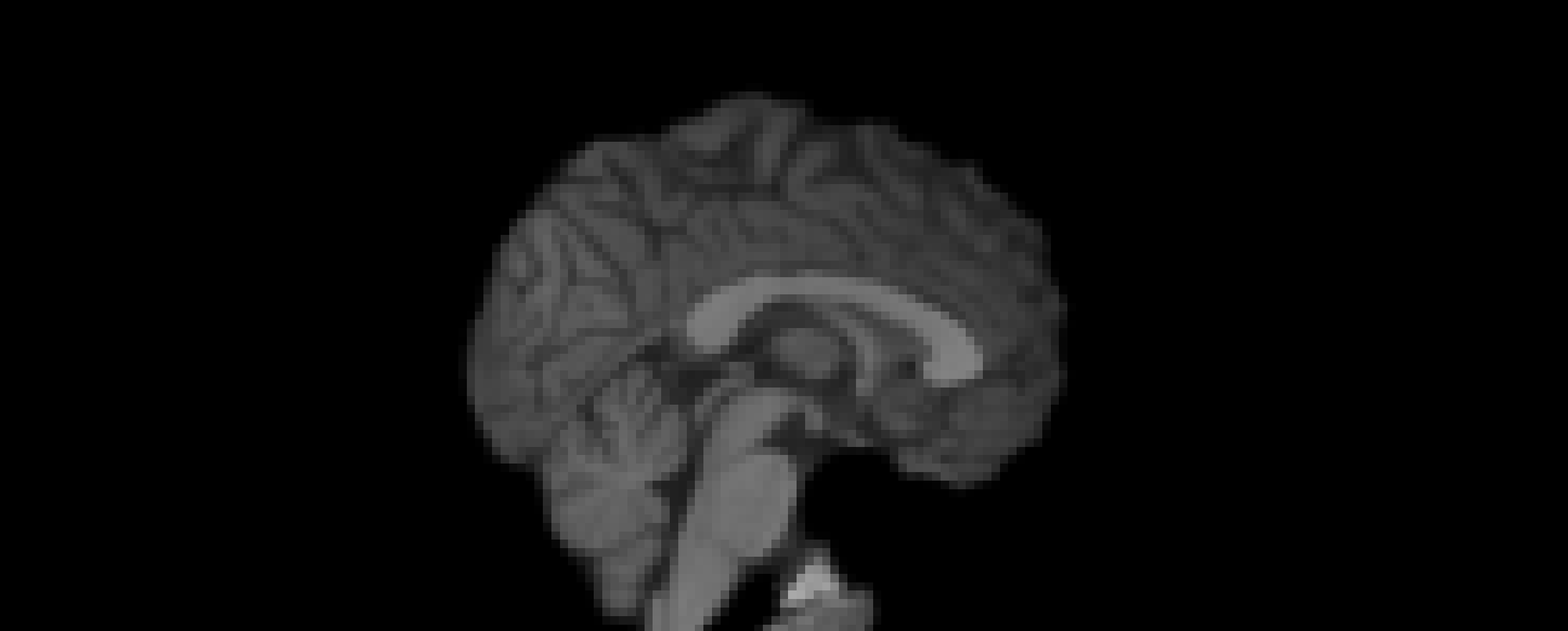6 DOF to MNI (2mm)